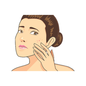 DMO03 I Acne vulgaris & Aknesonderformen