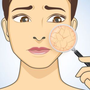 CSP04 I Papule ou vésicule - les symptômes-clés en dermatologie