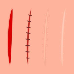 DMO118 I Haut mit Geschichte