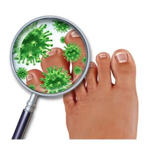 DMP17 I Pilznachweis in der Apotheke