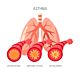 AL59 I Asthma bronchiale und Atemwegsdiagnostik