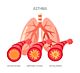 AO59 I Asthma bronchiale und Atemwegsdiagnostik