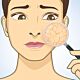 BP23 I Dermatologische Blickdiagnosen