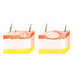 DP02 I ABC der Dermatologie