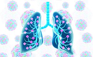 AL56 I Pneumologie: Triage und Therapiebegleitung