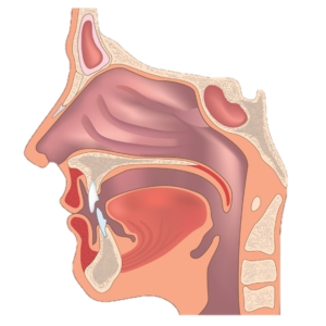 CP01 I Sphère nasale et bucco-pharyngée: Triage et traitements