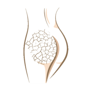 DP09 I Psoriasis - Naegel - Sonne