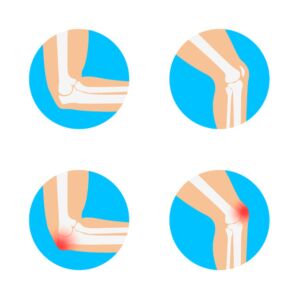 CO17 I Dorsalgies et douleurs articulaires: cas pratiques