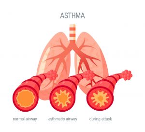 AO59 I Asthma bronchiale und Atemwegsdiagnostik